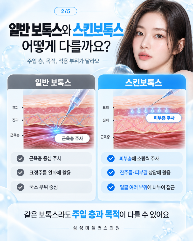 군산잔주름보톡스, 스킨보톡스는 일반 보톡스와 뭐가 다를까요? | 삼성미플러스의원 사진 2