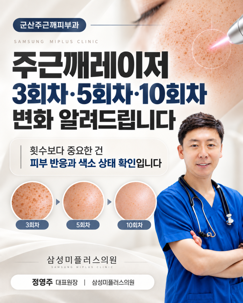 군산주근깨피부과, 주근깨레이저 3회차·5회차·10회차 변화 알려드립니다 [군산 삼성미플러스]
