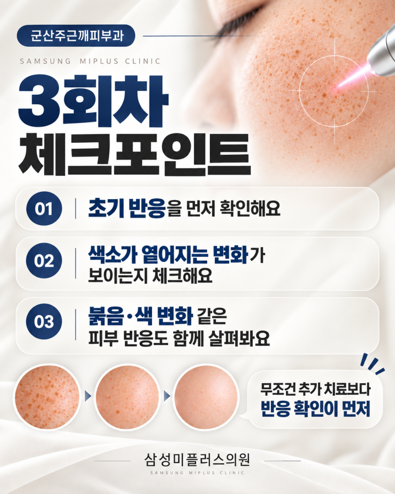 군산주근깨피부과, 주근깨레이저 3회차·5회차·10회차 변화 알려드립니다 [군산 삼성미플러스] 사진 3
