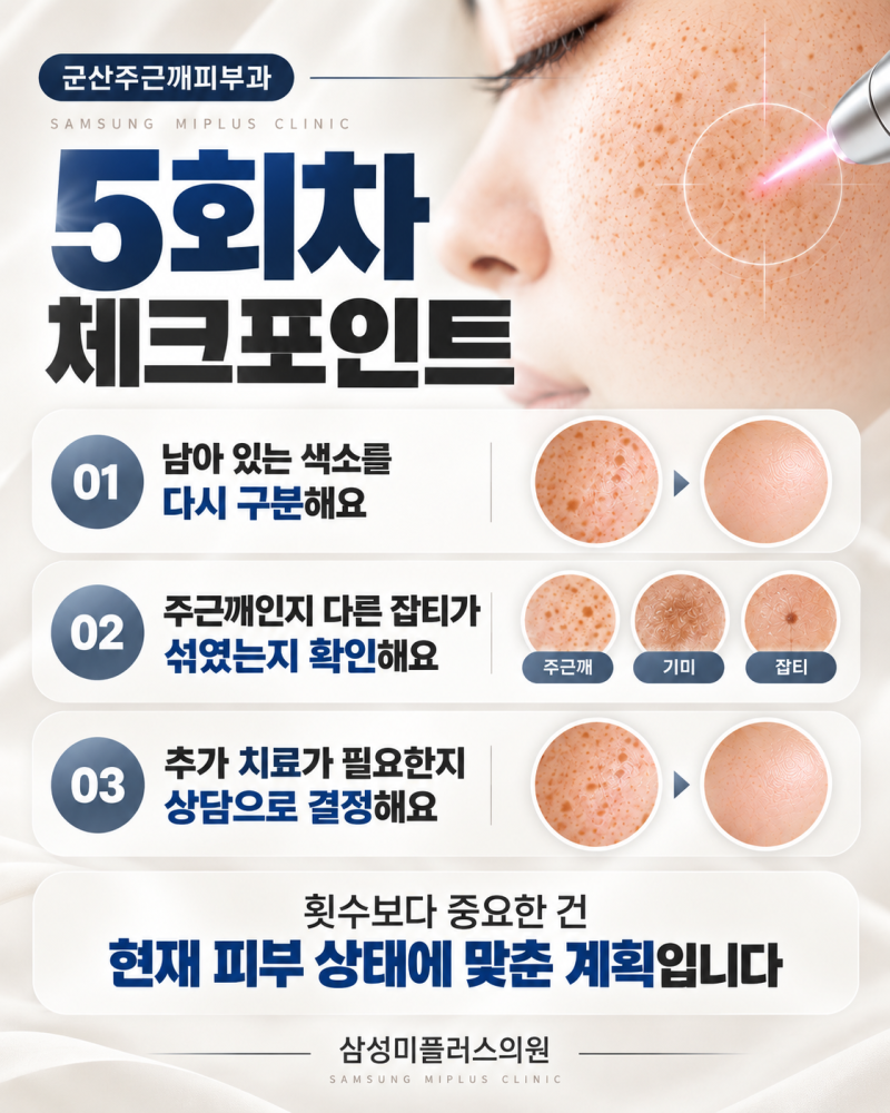 군산주근깨피부과, 주근깨레이저 3회차·5회차·10회차 변화 알려드립니다 [군산 삼성미플러스] 사진 4